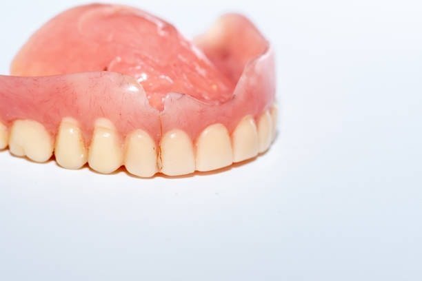 Broken Dentures can cut into your tongue or gums